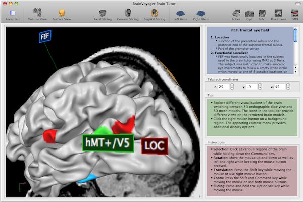 BrainVoyager QX picture or screenshot
